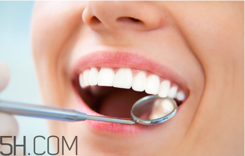 哪些情況不宜洗牙？洗牙后要注意什么？