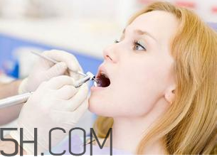 烤瓷牙洗牙要注意什么？洗牙的危害