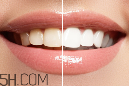 牙齒內(nèi)側(cè)的黃垢怎么去除？每天刷幾次牙齒最合適？