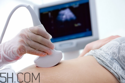 b超是檢查什么的？做b超時肚子上涂的是什么？