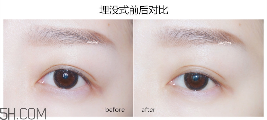 三種不同材質(zhì)雙眼皮貼的正確貼法圖 三種不同材質(zhì)雙眼皮貼的正確貼法圖