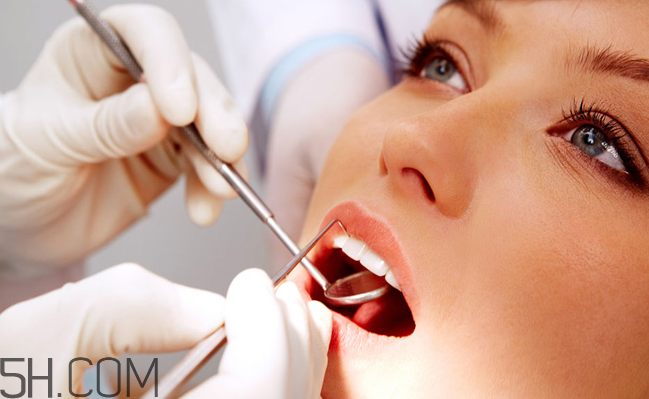 哪些情況不宜洗牙？洗牙后要注意什么？