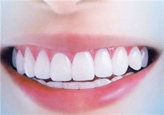 怎么用牙線(xiàn)？預(yù)防牙齒黃的方法