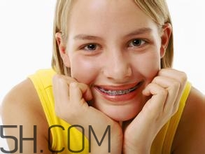 補(bǔ)牙需要帶牙套嗎？補(bǔ)牙后要裝牙套多少錢(qián)？