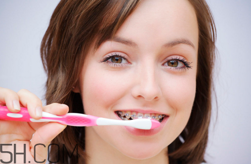 戴牙套可以懷孕嗎？牙齒矯正的后遺癥