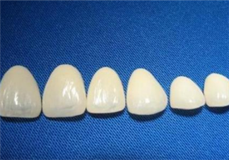 牙齒做貼面多少錢一顆？烤瓷牙可以取下來嗎？