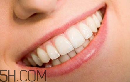 牙齒做貼面多少錢一顆？烤瓷牙可以取下來(lái)嗎？