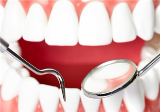 戴牙套可以懷孕嗎？牙齒矯正的后遺癥