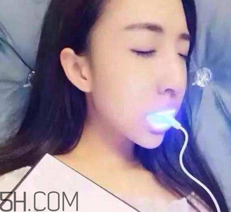 美牙儀可以兩個(gè)人用嗎？美牙儀用多久才有作用？