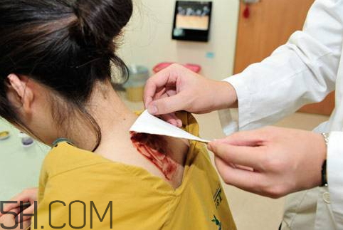 2018年三九貼多少錢 2018年三九多少錢一盒 2018年三九貼多少錢 2018年三九多少錢一盒