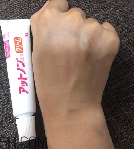 小林制藥祛疤膏有效嗎？小林制藥祛疤膏怎么樣？