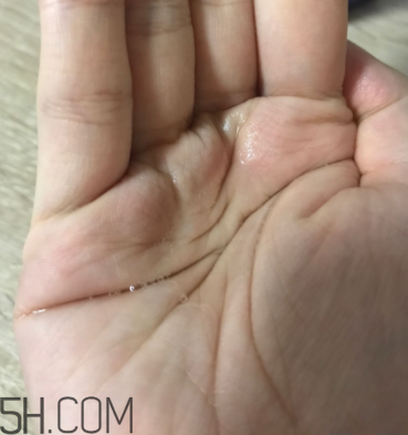 雪肌精卸妝油糊眼睛嗎？雪肌精卸妝油悶痘嗎？