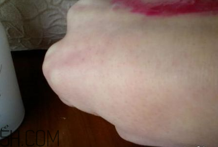 芭妮蘭卸妝膏用了長閉口怎么辦？芭妮蘭卸妝膏孕婦可以用嗎？