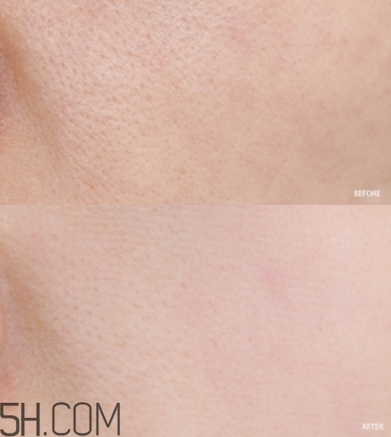 蘭蔻小黑瓶小嫩膜和前男友面膜哪個好？