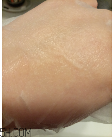 WIS痘肌修護(hù)面膜有效嗎？適合敏感肌嗎？