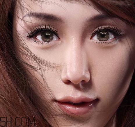 上瞼提肌手術有必要嗎？上瞼提肌后是永久的嗎？