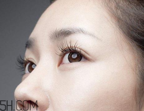 上瞼提肌手術有必要嗎？上瞼提肌后是永久的嗎？