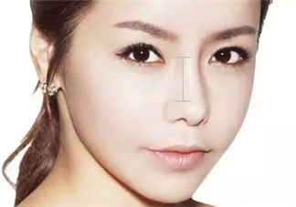 達拉斯隆鼻是什么材料？達拉斯隆鼻怎么樣？