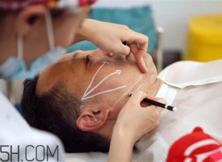 大v線提升有副作用嗎？大v線和小v線的區(qū)別