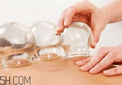 下雪天可以拔罐嗎 下雪天能拔罐嗎 下雪天可以拔罐嗎 下雪天能拔罐嗎