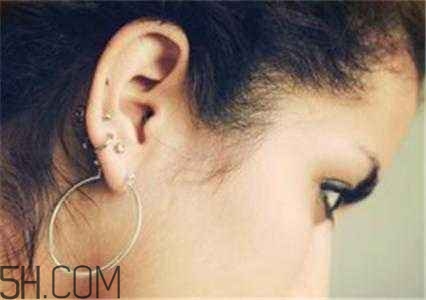 打耳洞后該如何預(yù)防感染？打耳洞前需要注意的細(xì)節(jié)？