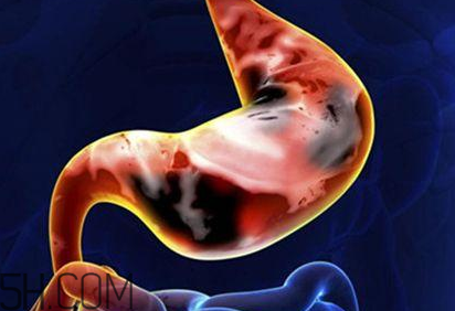 吃太燙會(huì)得癌？燙食不僅對(duì)胃不好還容易得癌