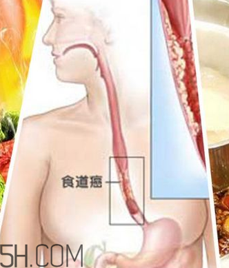 吃太燙會(huì)得癌？燙食不僅對(duì)胃不好還容易得癌