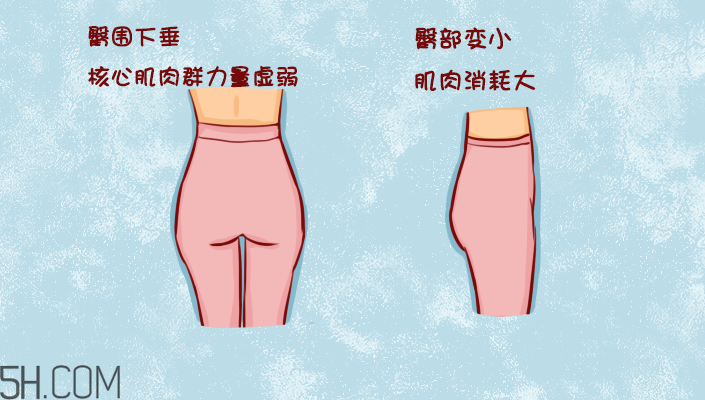 臀部護理對健康有什么影響？日常如何保養(yǎng)臀部健康？