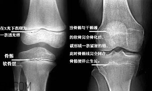 孩子學(xué)街舞好不好？學(xué)街舞好處多多