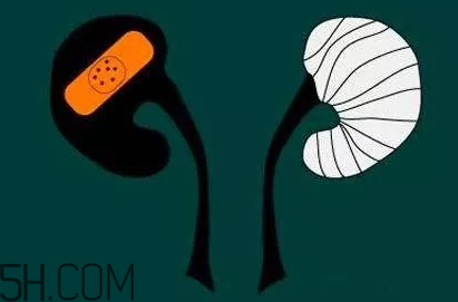 為什么容易得腎炎？慢性腎炎腎衰很難發(fā)現(xiàn)