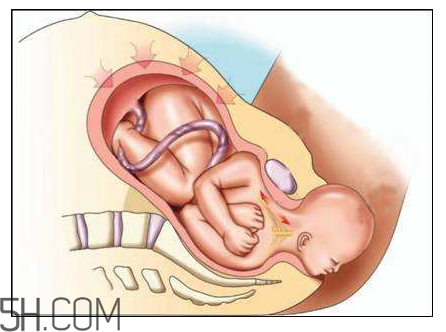分娩如斷骨？分娩痛感沒(méi)那么夸張