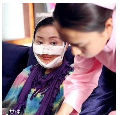 幻丑癥有多可怕？極端時會自戕