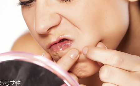 長(zhǎng)痘的根源是什么？原來(lái)是吃糖過(guò)多