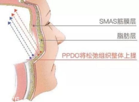 大v線會斷嗎？一定要選擇正規(guī)整形醫(yī)院