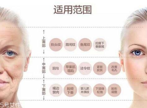 大v線會斷嗎？一定要選擇正規(guī)整形醫(yī)院