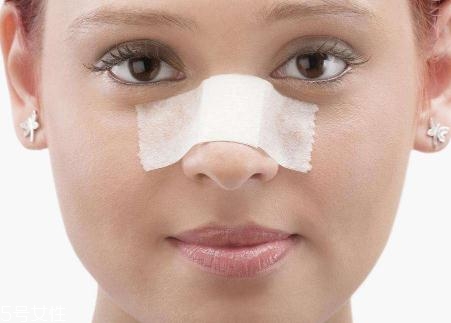 鼻小柱延長用什么材料？優(yōu)先選擇鼻中隔軟骨