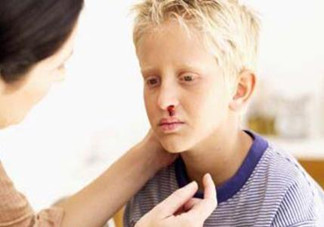 兒童流鼻血有何危害？治療要及時