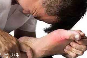 痛風(fēng)可以治愈嗎？無法治愈但能控制