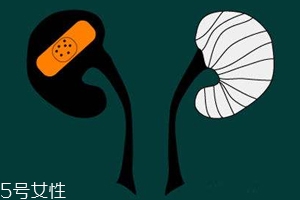 腎病為什么會發(fā)展到尿毒癥？這些因素一定要注意