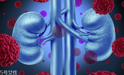 腎病為什么會發(fā)展到尿毒癥？這些因素一定要注意