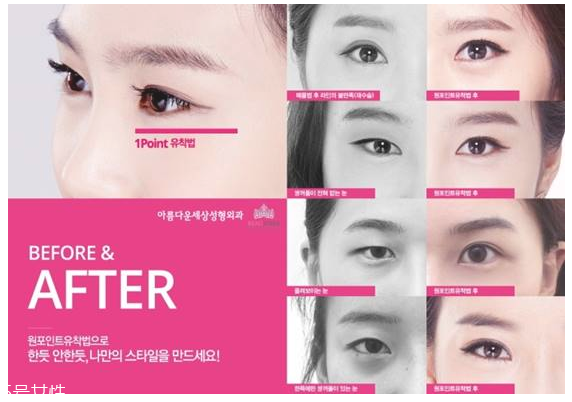 韓國人最愛整哪兒？韓國整形部位TOP4