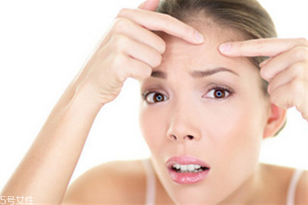 額頭毛孔粗大用什么護膚品？額頭毛孔粗大和出油有關系