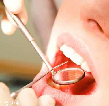 潰瘍的根源在哪里？也許僅僅只是牙膏沒(méi)選對(duì)