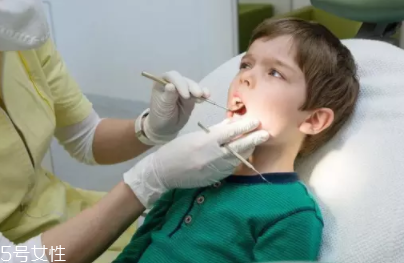 牙結(jié)石能自動脫落嗎？除了洗牙別無他法