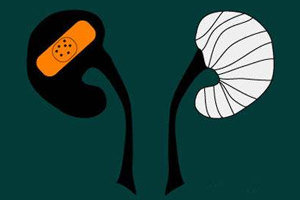 腎病為什么會(huì)發(fā)展到尿毒癥？這些因素一定要注意