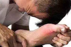 痛風(fēng)可以治愈嗎？無(wú)法治愈但能控制