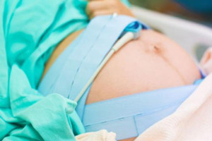 剖腹產(chǎn)坐月子該注意什么？保護傷口是關(guān)鍵