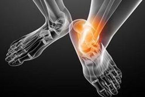 痛風(fēng)跟飲食有關(guān)？痛風(fēng)更多與遺傳有關(guān)