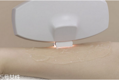 激光脫毛有哪些優(yōu)勢？激光脫毛的方式