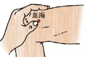 濕疹怎么治才管用？內(nèi)外同治是關鍵